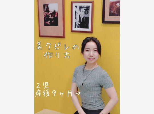 クビレ