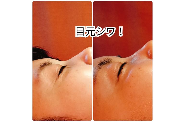 しわ