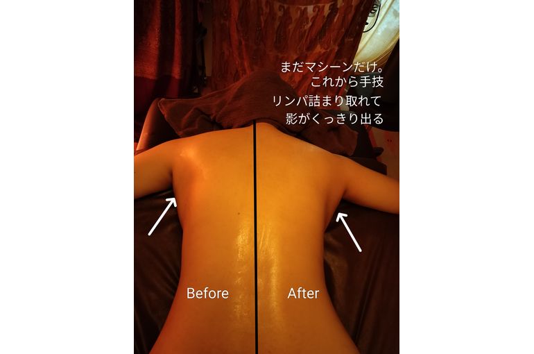 背中スッキリ